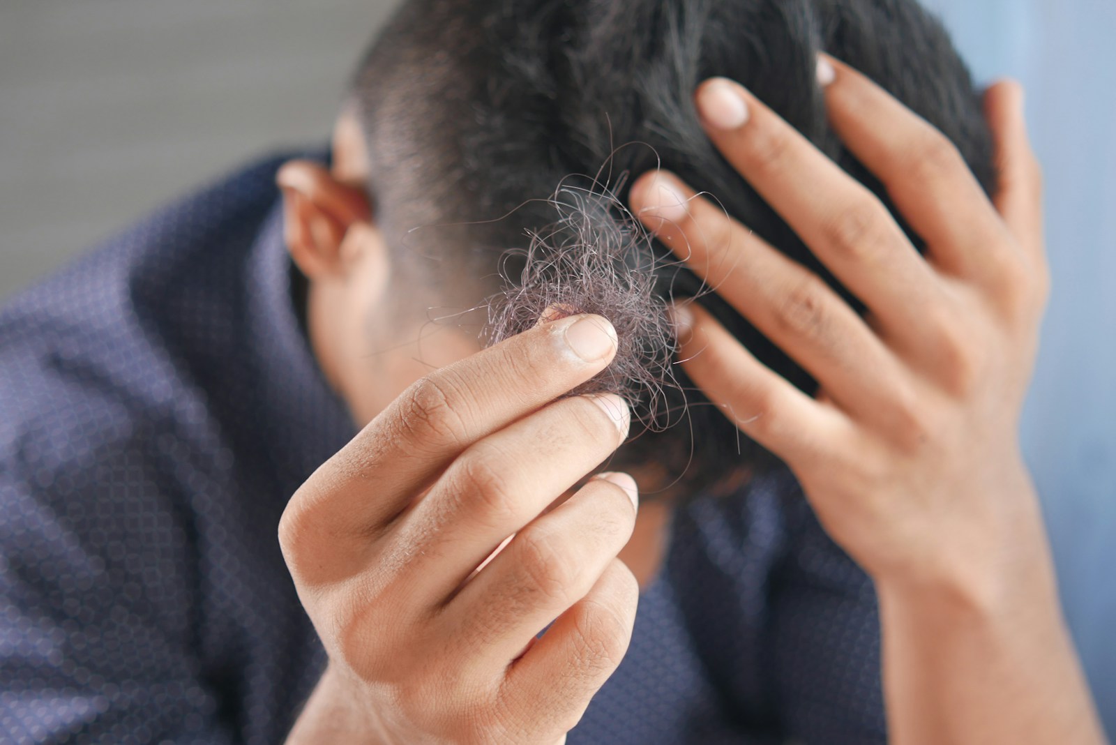 Adding PRP Hair Restoration to Your Mobile Practice